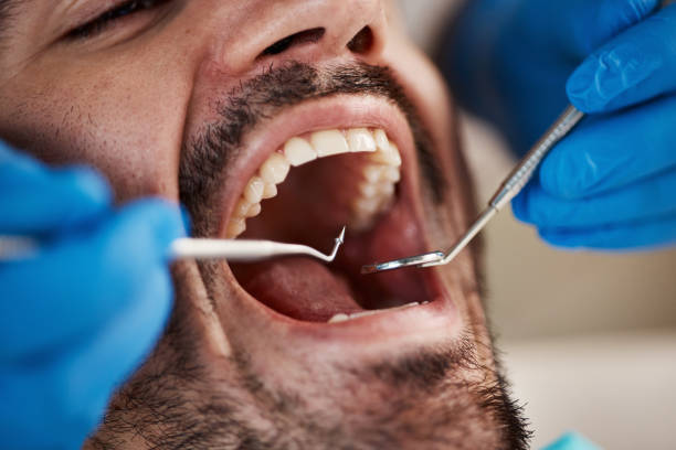 Best Weekend Emergency Dental Services in East Griffin, GA