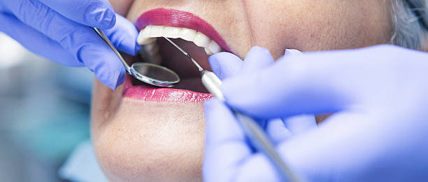 Best Emergency Treatment for Oral Infections in East Griffin, GA